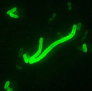 Yersinia pestis seen at 2000x magnification. This bacterium, carried and spread by fleas, is generally thought to have been the cause of millions of deaths.