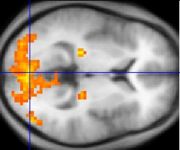 Since the 1980's, sophisticated neuroimaging procedures, such as fMRI (above), have furnished increasing knowledge about the workings of the human brain, shedding light on ancient philosophical problems.