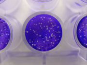 A viral plaque assay