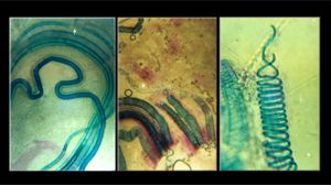 Photographs showing xylem elements in the shoot of a fig tree (Ficus alba): crushed in hydrochloric acid, between slides and cover slips.