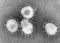 Electron micrograph of icosahedral virions