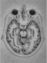 Brain MRI representation