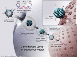 Gene therapy using an Adenovirus vector