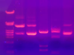 Gel electrophoresis