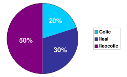 Distribution of gastrointestinal Crohn's disease. Based on data from American Gastroenterological Association.