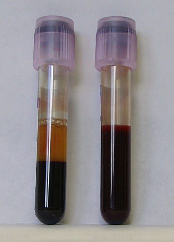 Image:Blut-EDTA.jpg