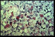 Mycobacterium leprae, the causative agent of leprosy. As acid-fast bacteria, M. leprae appear red when a Ziehl-Neelsen stain is used.