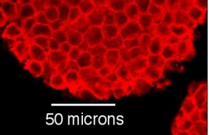 Mouse cells grown in a culture dish. These cells grow in large clumps, but each individual cell is about 10 micrometres across