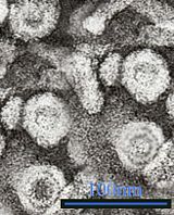 Micrograph showing hepatitis B virions