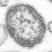 Measles virus