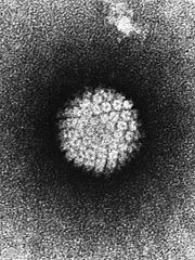 EM of papillomavirus