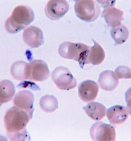 Plasmodium.jpg