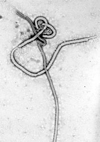 An electron micrograph of an Ebola virus