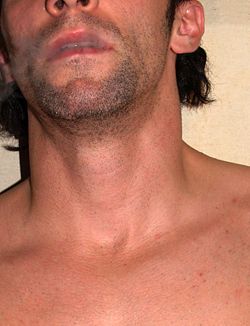 Neck by David Shankbone.jpg