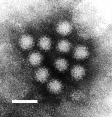 Transmission electron micrograph of noroviruses. The bar = 50 nm