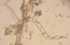 Unidentified roundworm from wet soil.The mouth is at the top left corner.