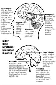 Two diagrams of major brain structures implicated in autism. The upper diagram shows the cerebral cortex near the top and the basal ganglia in the center, just above the amygdala and hippocampus. The lower diagram shows the corpus callosum near the center, the cerebellum in the lower rear, and the brain stem in the lower center.