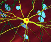 Closer view of neuron having a large central core with several tendrils branching out some of which branche again, the core of the contains an orange blob about a quarter of its diameter