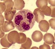 A round cell with a lobed nucleus surrounded by many slightly smaller red blood cells.