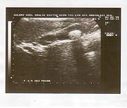 Ultrasound Scan ND 243.jpg