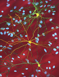 Several neurons coloured yellow and having a large central core with up to two dozen tendrils branching out of them, the core of the neuron in the foreground contains an orange blob about a quarter of its diameter