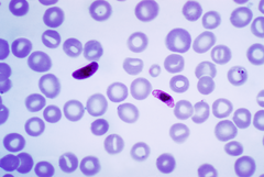 Plasmodium falciparum 01.png