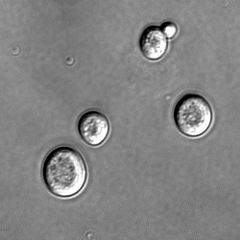 Microscopic view of five spherical structures; one of the spheres is considerably smaller than the rest and attached to one of the larger spheres