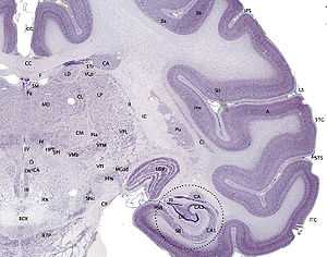 Brain slice showing areas CA1 and CA3 in hippocampus.