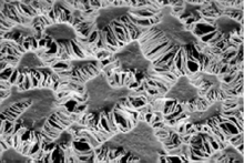 SEM image with islands of white and interconnecting strings