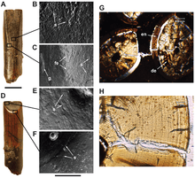 Pictures of the structures of the teeth