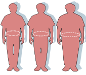 Three silhouettes depicting the outlines of a normal sized (left), overweight (middle), and obese person (right).