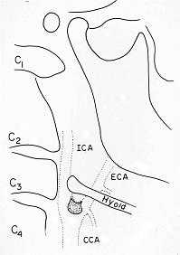 X-ray64B