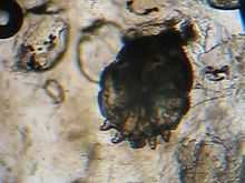 Video of the Sarcoptes scabiei mite