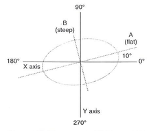 The base of a cornea with regular astigmatism.