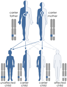 Illustration of autosomal recessive inheritance. Each parent has one blue allele and one white allele. Each of their 4 children inherit one allele from each parent such that one child ends up with two blue alleles, one child has two white alleles and two children have one of each allele. Only the child with both blue alleles shows the trait because the trait is recessive.