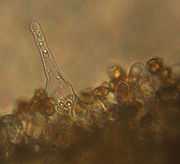 A translucent, pointed cell with a rounded tip extending upwards into a clear area. Its base is embedded amongst a layer of poorly-resolved smaller cells most of which are attached to up to four smaller oval brownish cells.