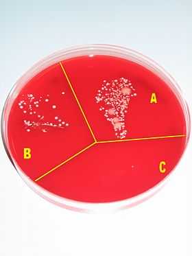 A Petri dish containing a red growth medium, and subdivided into three sectors, labeled A, B and C, respectively. There is much visible microbial growth in culture A, some growth in culture B, and virtually no growth in culture C.