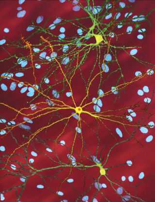 Several neurons colored yellow and having a large central core with up to two dozen tendrils branching out of them, the core of the neuron in the foreground contains an orange blob about a quarter of its diameter