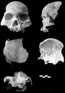 Reconstructed skull (top left) with skull fragments