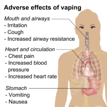 Adverse effects of vaping include throat irritation, cough, increased airway resistance, nausea, vomiting, chest pain, increased blood pressure, and increased heart rate.