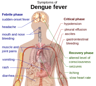 Outline of a human torso with arrows indicating the organs affected in the various stages of dengue fever