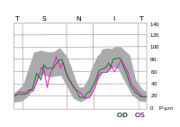 TSNIT graph