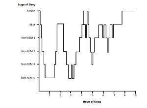 Example hypnogram for a normal, healthy adult. Within the first hour of sleep SWS is displayed. Cycles of REM and NREM sleep proceed. During the third cycle of sleep there are two brief wake states. During the second half of the sleep period more REM sleep is displayed and there is little SWS detected.