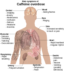 Torso of a young man with overlaid text of main side-effects of caffeine overdose.