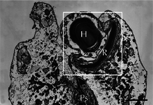 Grayscale electron micrograph of an ocelloid in its cellular context. Due to the microscopy technique used, the normally translucent hyalosome appears almost as darkly stained as the retinal body.