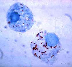 Two round cells with many tiny rod-shaped bacteria inside.