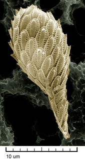 High magnification SEM image of a single Synura cell. It is covered with about 50 delicate, oval scales.