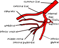 Variation 5 of internal iliac artery branching.svg