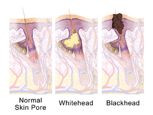 Three images illustrating hair follicle anatomy