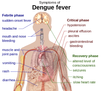 Outline of a human torso with arrows indicating the organs affected in the various stages of dengue fever